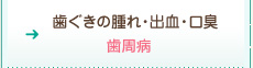 歯ぐきの腫れ・出血・口臭：歯周病