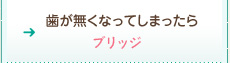 歯が無くなってしまったら：ブリッジ