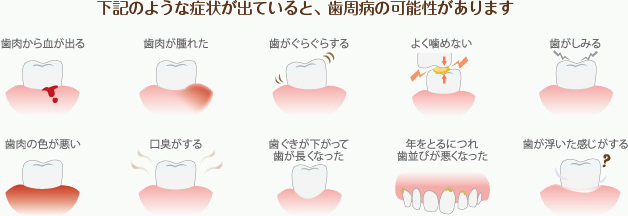 下記のような症状が出ていると、歯周病の可能性があります。